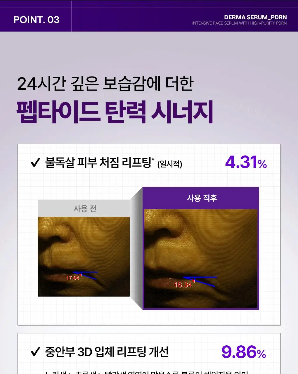 [업그레이드 모공탄력세럼] 메디힐 PDRN 더마 세럼 50mL 상세페이지 16